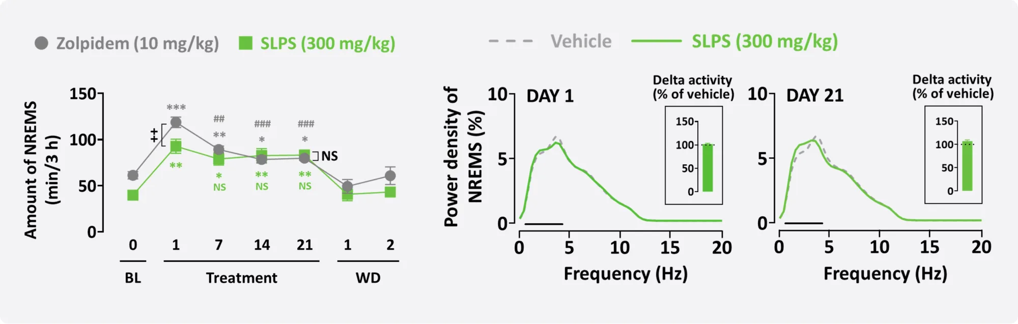 Long-term EEG study charts